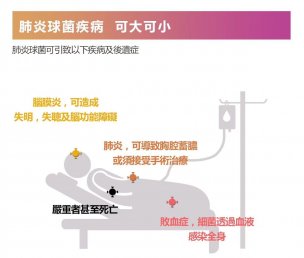 13价肺炎疫苗